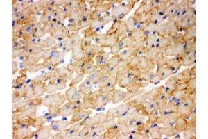 IHC testing of frozen rat heart tissue with CPT1B antibody. (CPT1B anticorps)