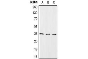 Western blot analysis of RASSF2 expression in HeLa (A), NIH3T3 (B), H9C2 (C) whole cell lysates.
