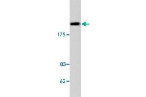 Western blot analysis of Jurkat cell lysate with TOP2B polyclonal antibody . (TOP2B anticorps)