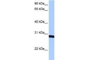 WB Suggested Anti-SMN1 Antibody  Titration: 0. (SMN1 anticorps  (N-Term))