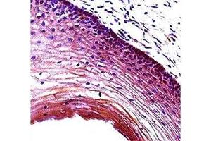 Puma antibody immunohistochemistry analysis in formalin fixed and paraffin embedded human cervix tissue.