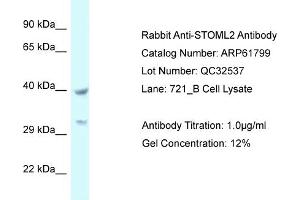 Western Blotting (WB) image for anti-Stomatin (EPB72)-Like 2 (STOML2) (C-Term) antibody (ABIN2788905) (STOML2 anticorps  (C-Term))