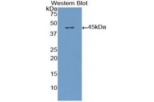 Western blot analysis of the recombinant protein. (beta-Thromboglobulin anticorps  (AA 1-119))