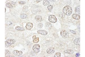Immunohistochemistry (IHC) image for anti-Nucleoporin 50kDa (NUP50) (AA 418-468) antibody (ABIN7448703) (NUP50 anticorps  (AA 418-468))
