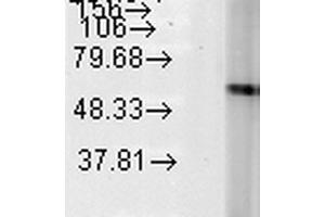 Western Blot analysis of Human Heat Shocked HeLa cell lysates showing detection of Hsp60 protein using Mouse Anti-Hsp60 Monoclonal Antibody, Clone LK-2 . (HSPD1 anticorps  (Biotin))