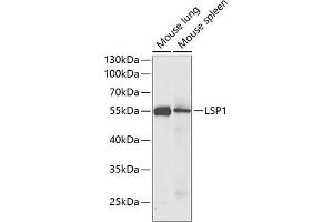 Western blot analysis of extracts of various cell lines, using LSP1 antibody (ABIN6130532, ABIN6143368, ABIN6143370 and ABIN6221252) at 1:1000 dilution. (LSP1 anticorps  (AA 1-339))