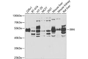 Western blot analysis of extracts of various cell lines, using IRF6 antibody  at 1:1000 dilution. (IRF6 anticorps  (AA 115-300))