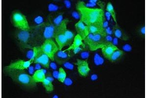 IF analysis of Psoriasin using anti-Psoriasin antibody (ABIN5692925). (S100A7 anticorps  (AA 2-101))