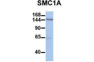 Host:  Rabbit  Target Name:  SMC1A  Sample Type:  Human HepG2  Antibody Dilution:  1. (SMC1A anticorps  (C-Term))
