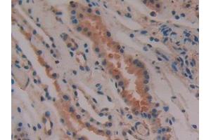 Detection of PTGDS in Human Kidney Tissue using Polyclonal Antibody to Prostaglandin-H2 D-isomerase (PTGDS)