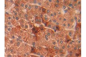 anti-Interleukin 1 Receptor Accessory Protein (IL1RAP) (AA 420-558) antibody