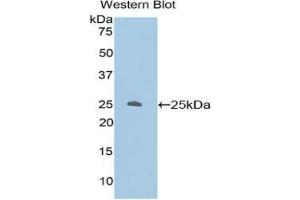 Western blot analysis of the recombinant protein. (PKC zeta anticorps  (AA 404-591))