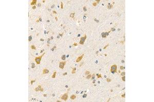 Immunohistochemistry of paraffin embedded rat brain using Rac3 (ABIN7075378) at dilution of 1:2000 (400x lens) (RAC3 anticorps)