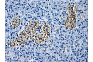 Immunohistochemistry (IHC) image for anti-Histone Deacetylase 10 (HDAC10) antibody (ABIN1498610) (HDAC10 anticorps)