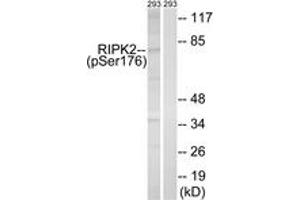 Western blot analysis of extracts from 293 cells treated with UV 15', using RIPK2 (Phospho-Ser176) Antibody. (RIPK2 anticorps  (pSer176))