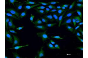 Immunofluorescence of purified MaxPab antibody to FLJ22662 on HeLa cell. (FLJ22662 (AA 1-223) anticorps)
