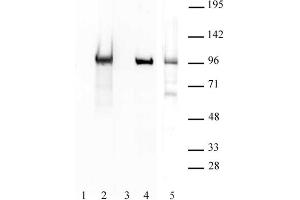 BORIS / CTCFL antibody (pAb) tested by Western blot. (CTCFL anticorps  (N-Term))