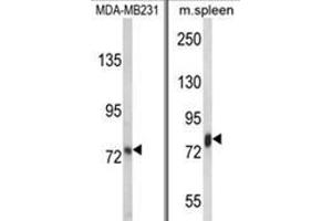(LEFT) Western blot analysis of LTF Antibody in MDA-MB231 cell line lysates (35ug/lane). (Lactoferrin anticorps)