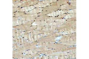 IHC analysis of ACSS2 using anti-ACSS2 antibody (ABIN7600569). (ACSS2 anticorps  (AA 201-651))