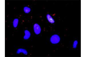 anti-CREB Binding Protein (CREBBP) (AA 951-1050) antibody