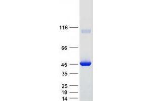 Validation with Western Blot