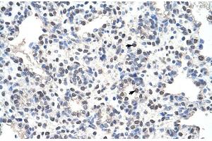 Rabbit Anti-NCL Antibody Catalog Number: ARP40583 Paraffin Embedded Tissue: Human Lung Cellular Data: Alveolar cells Antibody Concentration: 4. (Nucleolin anticorps  (N-Term))