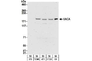 anti-Uveal Autoantigen With Coiled Coil Domains And Ankyrin Repeats (UACA) (AA 1075-1125) antibody