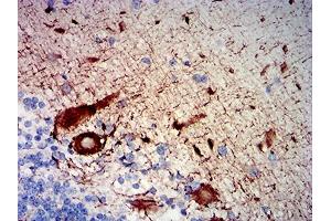 Immunohistochemical analysis of paraffin-embedded human cerebellum tissues using NEFH mouse mAb with DAB staining. (NEFH anticorps  (AA 2-251))