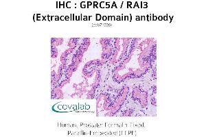 Image no. 1 for anti-G Protein-Coupled Receptor, Family C, Group 5, Member A (GPRC5A) (2nd Extracellular Domain) antibody (ABIN1735207) (GPRC5A anticorps  (2nd Extracellular Domain))