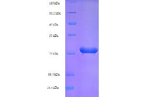 SDS-PAGE (SDS) image for Human Papilloma Virus 16 E7 (HPV-16 E7) (AA 1-99), (full length) protein (His-SUMO Tag) (ABIN5710924)