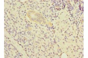 Immunohistochemistry of paraffin-embedded human pancreatic tissue using ABIN7161966 at dilution of 1:100 (Nucleolar Protein 1 (NOL1) (AA 1-210) anticorps)