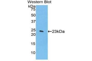 Western blot analysis of the recombinant protein. (SPTAN1 anticorps  (AA 1950-2137))