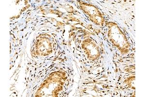 anti-Microtubule-Associated Protein 1S (MAP1S) (Internal Region) antibody