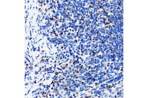 Immunohistochemistry of paraffin-embedded mouse spleen using HuR/EL antibody (ABIN7266913) at dilution of 1:100 (40x lens).