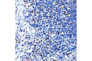 Immunohistochemistry of paraffin-embedded mouse spleen using HuR/EL antibody (ABIN7266913) at dilution of 1:100 (40x lens). (ELAVL1 anticorps)