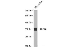 Western blot analysis of extracts of Mouse liver using PRKRA Polyclonal Antibody at dilution of 1:1000. (PRKRA anticorps)
