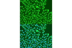 Immunofluorescence analysis of U2OS cells using Phospho-DNA-PKcs-S2056 antibody (ABIN6135292, ABIN6136206, ABIN6136207 and ABIN6225632) at dilution of 1:100. (PRKDC anticorps  (pSer2056))