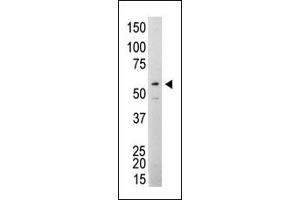 The anti-Src Mab (ABIN387822 and ABIN2843908) is used in Western blot to detect Src in Jurkat cell lysate.
