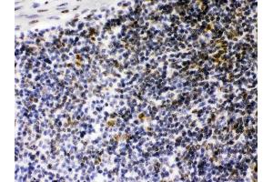 CIITA was detected in paraffin-embedded sections of mouse spleen tissues using rabbit anti- CIITA Antigen Affinity purified polyclonal antibody (Catalog # ) at 1 µg/mL.