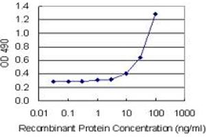 Sandwich ELISA detection sensitivity ranging from 10 ng/mL to 100 ng/mL. (TAGLN (Humain) Matched Antibody Pair)