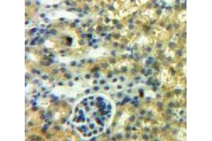 Used in DAB staining on fromalin fixed paraffin-embedded Kidney tissue