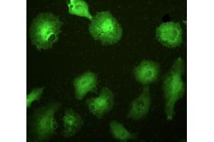 Detection of IL1RL1 in A549 cells using Polyclonal Antibody to Interleukin 1 Receptor Like Protein 1 (IL1RL1) (IL1RL1 anticorps  (AA 162-349))