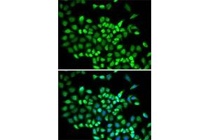 Immunofluorescence analysis of A-549 cells using Cullin 2 antibody (ABIN6129299, ABIN6139249, ABIN6139250 and ABIN6220930). (Cullin 2 anticorps  (AA 40-310))