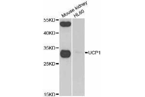 Western blot analysis of extracts of various cell lines, using UCP1 antibody. (UCP1 anticorps  (AA 1-307))