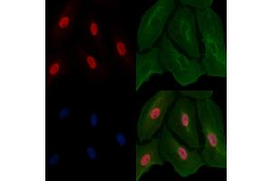ABIN6261157 and ABIN6266615 staining  cells by IF/ICC. (Cyclin L1 anticorps  (C-Term))