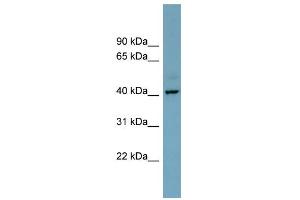 WB Suggested Anti-CXorf66 Antibody Titration:  0. (CXorf66 anticorps  (Middle Region))