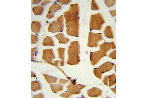 Formalin-fixed and paraffin-embedded human skeletal muscle reacted with BMI1 Antibody , which was peroxidase-conjugated to the secondary antibody, followed by DAB staining. (BMI1 anticorps  (C-Term))