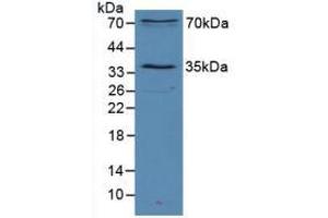 Western blot analysis of Mouse Heart Tissue. (SIRT2 anticorps  (AA 65-340))