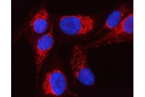 IF analysis of PTPIP51/RMDN3 using anti-PTPIP51/RMDN3 antibody (ABIN7601775). (RMDN3 anticorps  (AA 45-438))