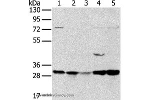 Western blot analysis of 293T and MCF7 cell, mouse brain tissue and K562 cell, mouse bladder tissue, using TPD52L2 Polyclonal Antibody at dilution of 1:400